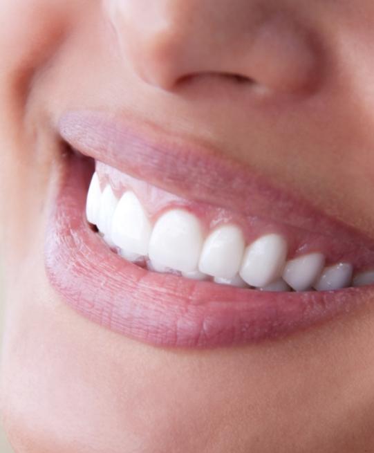Close up of bright smile after teeth whitening in Arlington Heights